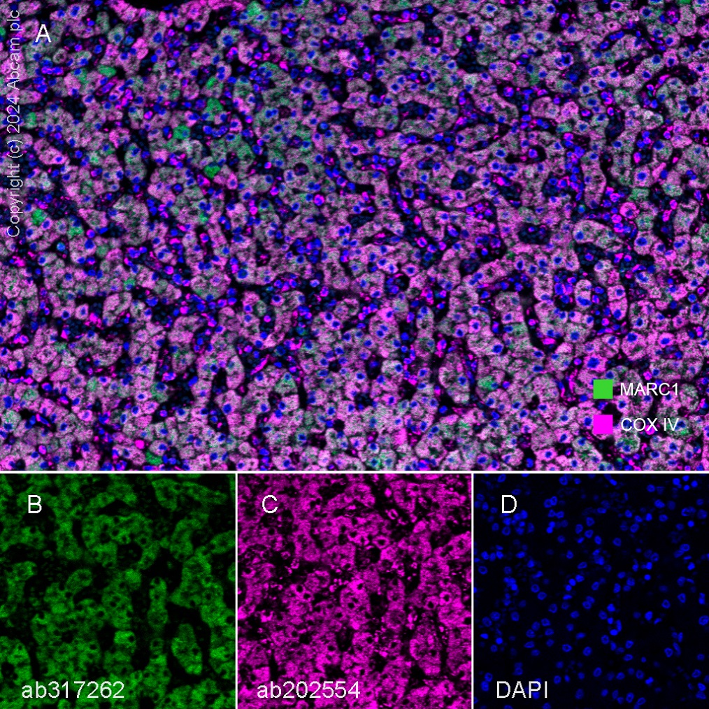 Multiplex immunohistochemistry - Anti-MARC1 antibody [EPR28272-93] - BSA and Azide free (ab317263), expandable thumbnail