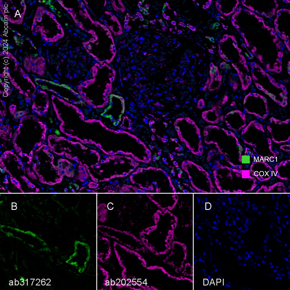 Multiplex immunohistochemistry - Anti-MARC1 antibody [EPR28272-93] - BSA and Azide free (ab317263), expandable thumbnail