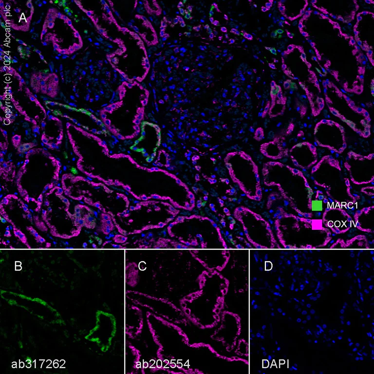 Multiplex immunohistochemistry - Anti-MARC1 antibody [EPR28272-93] - BSA and Azide free (AB317263)