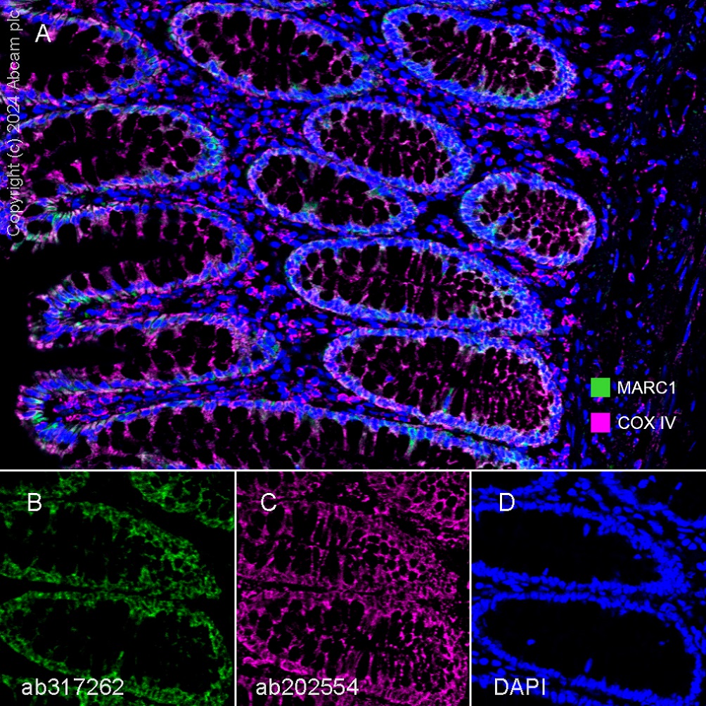 Multiplex immunohistochemistry - Anti-MARC1 antibody [EPR28272-93] - BSA and Azide free (ab317263), expandable thumbnail