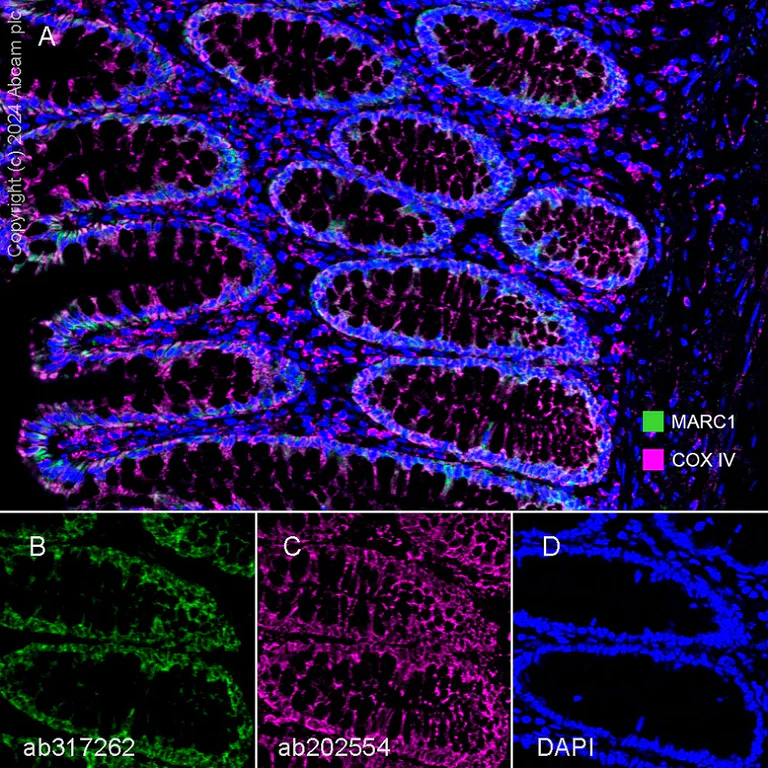 Multiplex immunohistochemistry - Anti-MARC1 antibody [EPR28272-93] - BSA and Azide free (AB317263)