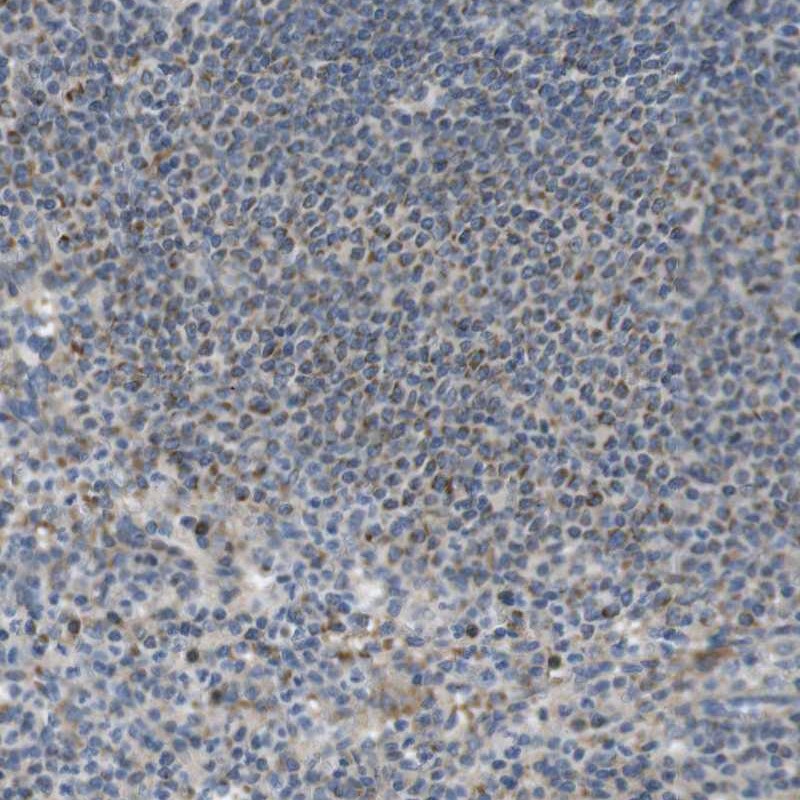 Immunohistochemistry (Formalin/PFA-fixed paraffin-embedded sections) - Anti-MARCH-I antibody (AB251706)