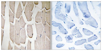 Immunohistochemistry (Formalin/PFA-fixed paraffin-embedded sections) - Anti-MARCH3 antibody (AB137261)