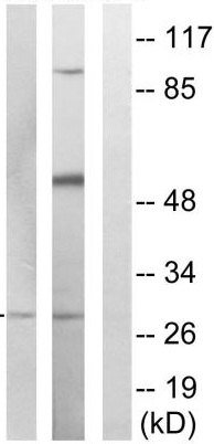 Western blot - Anti-MARCH3 antibody (AB137261)