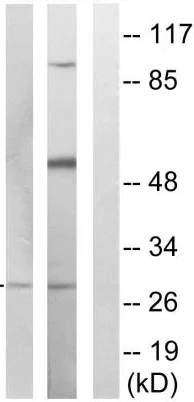 Western blot - Anti-MARCH3 antibody (AB137261)