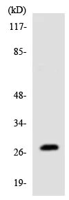 Western blot - Anti-MARCH3 antibody (AB137261)
