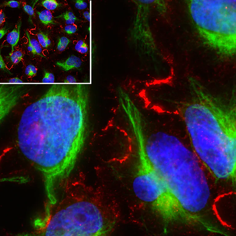 Immunocytochemistry/ Immunofluorescence - Anti-MARCKS antibody [5F9] (AB315205)