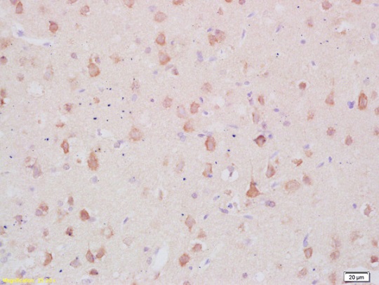 Immunohistochemistry (Formalin/PFA-fixed paraffin-embedded sections) - Anti-MARCKS antibody (AB217695), expandable thumbnail