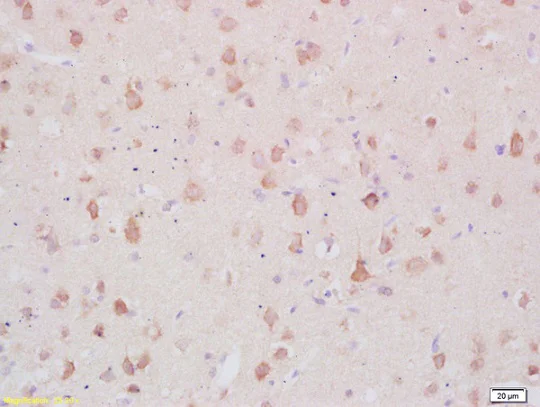 Immunohistochemistry (Formalin/PFA-fixed paraffin-embedded sections) - Anti-MARCKS antibody (AB217695)