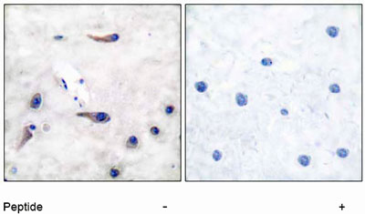 Immunohistochemistry (Formalin/PFA-fixed paraffin-embedded sections) - Anti-MARCKS antibody (AB51100)