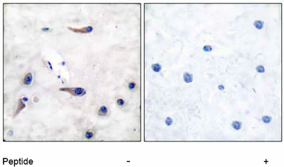 Immunohistochemistry (Formalin/PFA-fixed paraffin-embedded sections) - Anti-MARCKS antibody (AB51100)