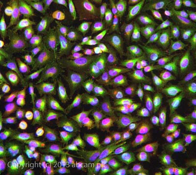Immunocytochemistry/ Immunofluorescence - Anti-MARCKS antibody [EP1446Y] (AB52616)