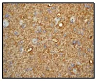 Immunohistochemistry (Formalin/PFA-fixed paraffin-embedded sections) - Anti-MARCKS antibody [EP1446Y] (AB52616)