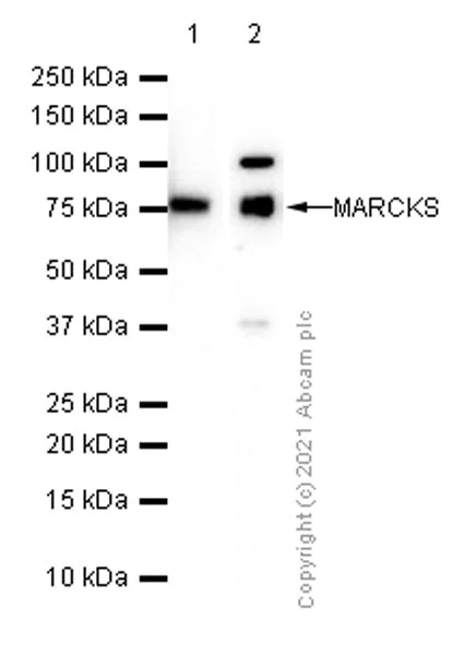 Western blot - Anti-MARCKS antibody [EP1446Y] (AB52616)