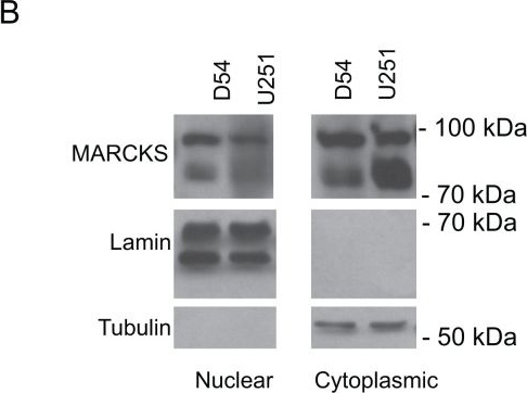 Western blot - Anti-MARCKS antibody [EP1446Y] (ab52616), expandable thumbnail
