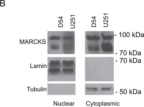 Western blot - Anti-MARCKS antibody [EP1446Y] (AB52616)