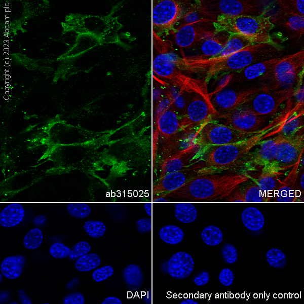 Immunocytochemistry/ Immunofluorescence - Anti-MARCKS antibody [EPR28261-90] (AB315025), expandable thumbnail
