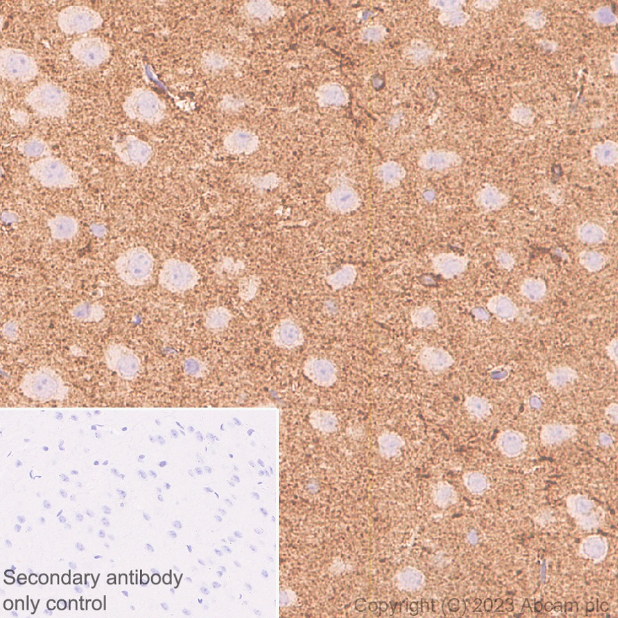 Immunohistochemistry (Formalin/PFA-fixed paraffin-embedded sections) - Anti-MARCKS antibody [EPR28261-90] (ab315025), expandable thumbnail