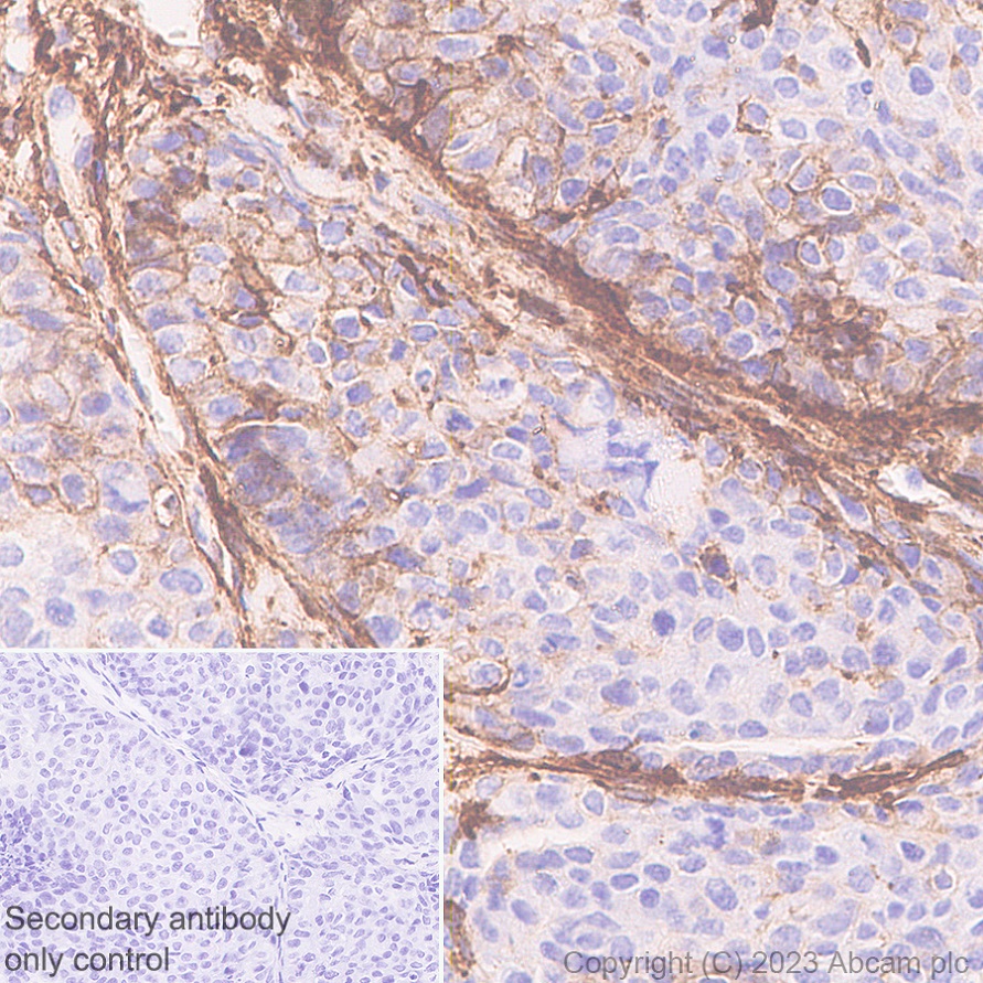Immunohistochemistry (Formalin/PFA-fixed paraffin-embedded sections) - Anti-MARCKS antibody [EPR28261-90] (ab315025), expandable thumbnail