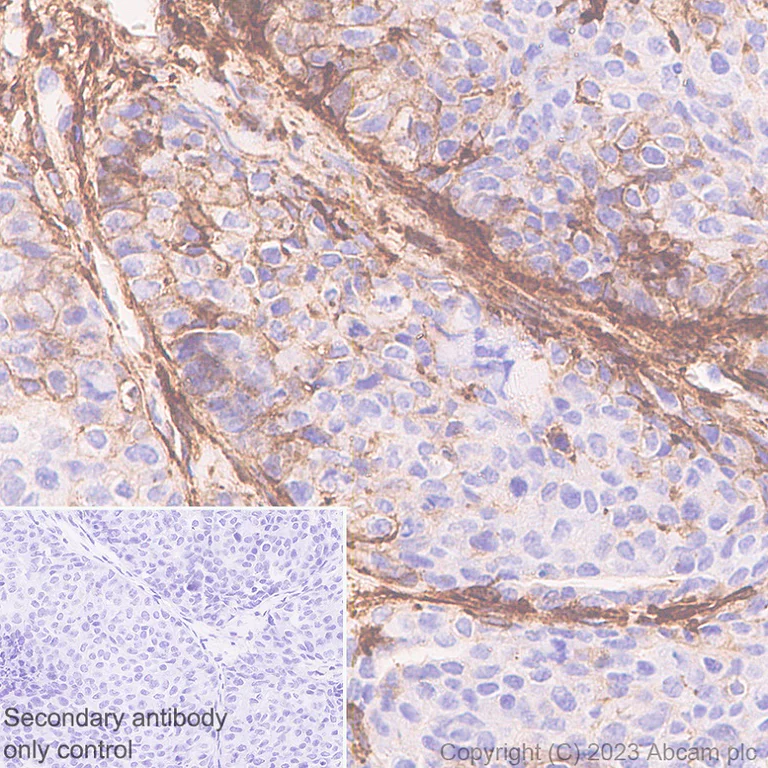 Immunohistochemistry (Formalin/PFA-fixed paraffin-embedded sections) - Anti-MARCKS antibody [EPR28261-90] (AB315025)