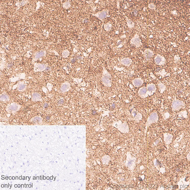 Immunohistochemistry (Formalin/PFA-fixed paraffin-embedded sections) - Anti-MARCKS antibody [EPR28261-90] (AB315025)