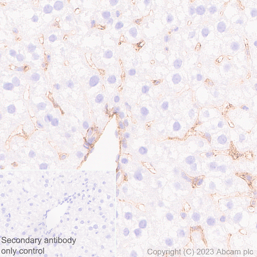 Immunohistochemistry (Formalin/PFA-fixed paraffin-embedded sections) - Anti-MARCKS antibody [EPR28261-90] (ab315025), expandable thumbnail