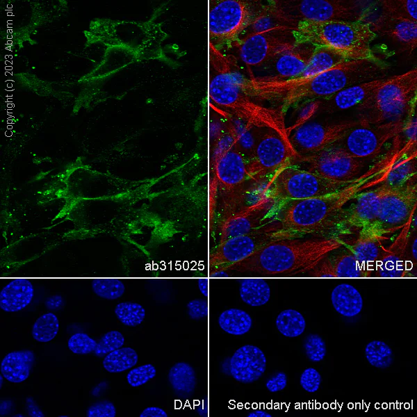Immunocytochemistry/ Immunofluorescence - Anti-MARCKS antibody [EPR28261-90] - BSA and Azide free (AB315026)