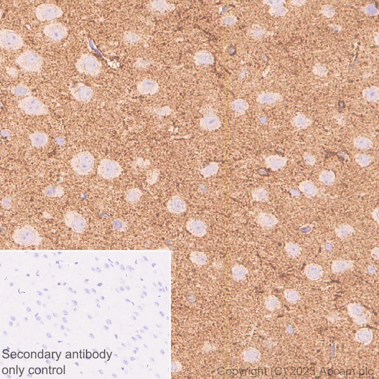 Immunohistochemistry (Formalin/PFA-fixed paraffin-embedded sections) - Anti-MARCKS antibody [EPR28261-90] - BSA and Azide free (AB315026)