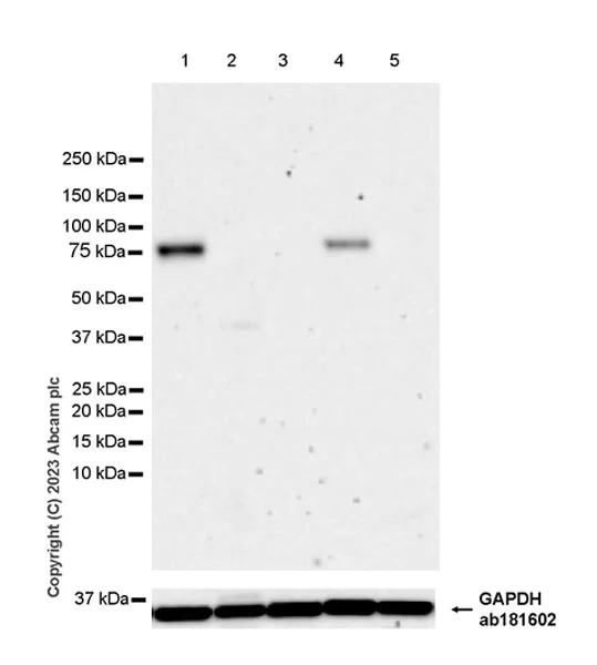 Western blot - Anti-MARCKS antibody [EPR28261-90] - BSA and Azide free (AB315026)