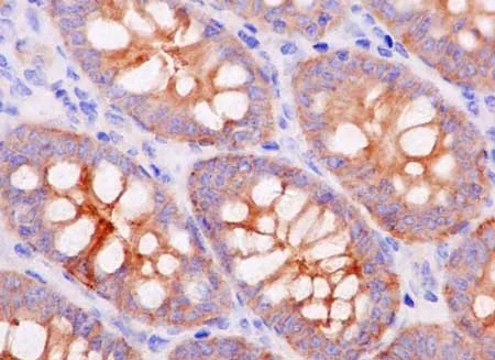Immunohistochemistry (Formalin/PFA-fixed paraffin-embedded sections) - Anti-MARCKS like protein antibody [EPR15353] - C-terminal (AB184546)