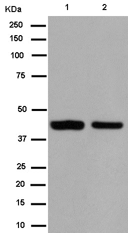 Western blot - Anti-MARCKS like protein antibody [EPR15353] - C-terminal (AB184546), expandable thumbnail
