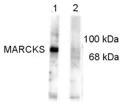 Western blot - Anti-MARCKS (phospho S152 + S156) antibody (AB32590)