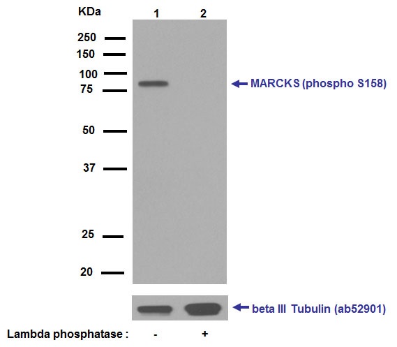 Western blot - Anti-MARCKS (phospho S158) antibody [EP2113Y] - BSA and Azide free (AB239900)