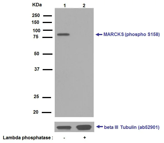 Western blot - Anti-MARCKS (phospho S158) antibody [EP2113Y] - BSA and Azide free (AB239900)