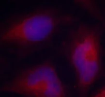 Immunocytochemistry/ Immunofluorescence - Anti-MARCKS (phospho S162) antibody (AB194804)