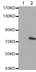 Western blot - Anti-MARCKS (phospho S162) antibody (AB194804)