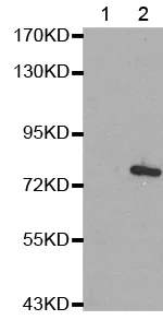 Western blot - Anti-MARCKS (phospho S162) antibody (AB194804)