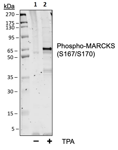 Western blot - Anti-MARCKS (phospho S167 + S170) antibody [MARCKSS167170-C9] (AB278646), expandable thumbnail