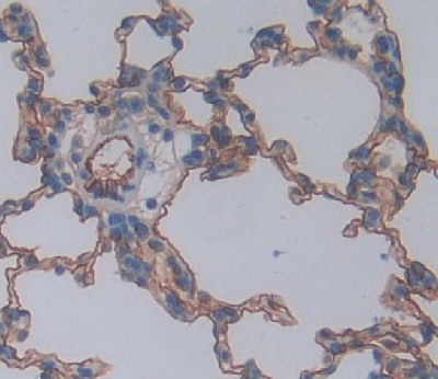 Immunohistochemistry (Formalin/PFA-fixed paraffin-embedded sections) - Anti-MARCO antibody (AB231046)