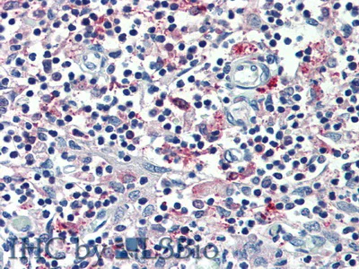 Immunohistochemistry (Formalin/PFA-fixed paraffin-embedded sections) - Anti-MARCO antibody (AB231046)