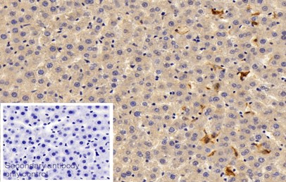 Immunohistochemistry (Formalin/PFA-fixed paraffin-embedded sections) - Anti-MARCO antibody (AB231046)