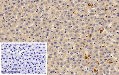 Immunohistochemistry (Formalin/PFA-fixed paraffin-embedded sections) - Anti-MARCO antibody (AB231046)