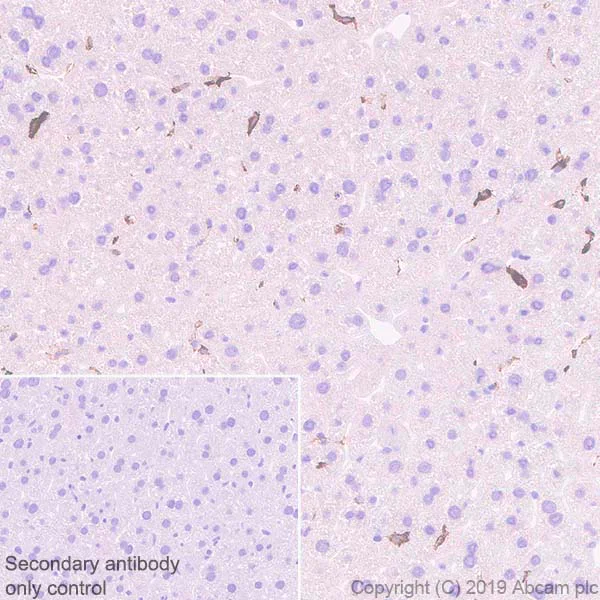 Immunohistochemistry (Formalin/PFA-fixed paraffin-embedded sections) - Anti-MARCO antibody [EPR22944-64] - BSA and Azide free (AB256822)