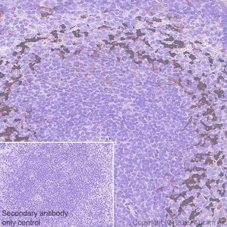 Immunohistochemistry (Formalin/PFA-fixed paraffin-embedded sections) - Anti-MARCO antibody [EPR22944-64] - BSA and Azide free (AB256822)