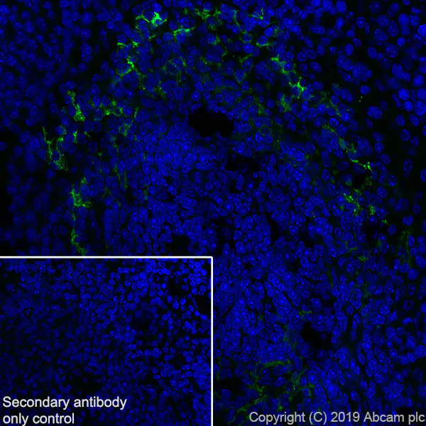 Immunohistochemistry (Frozen sections) - Anti-MARCO antibody [EPR22944-64] - BSA and Azide free (AB256822)
