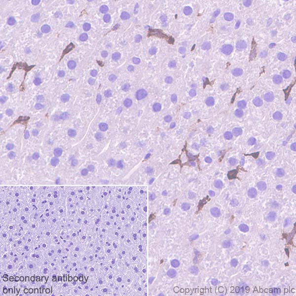 Immunohistochemistry (Formalin/PFA-fixed paraffin-embedded sections) - Anti-MARCO antibody [EPR22944-66] (AB259264), expandable thumbnail