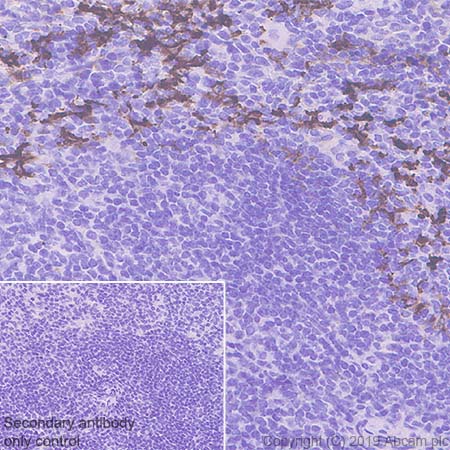 Immunohistochemistry (Formalin/PFA-fixed paraffin-embedded sections) - Anti-MARCO antibody [EPR22944-66] (AB259264), expandable thumbnail