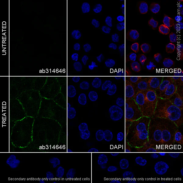 Immunocytochemistry/ Immunofluorescence - Anti-MARCO antibody [EPR26935-11] - BSA and Azide free (AB314647)
