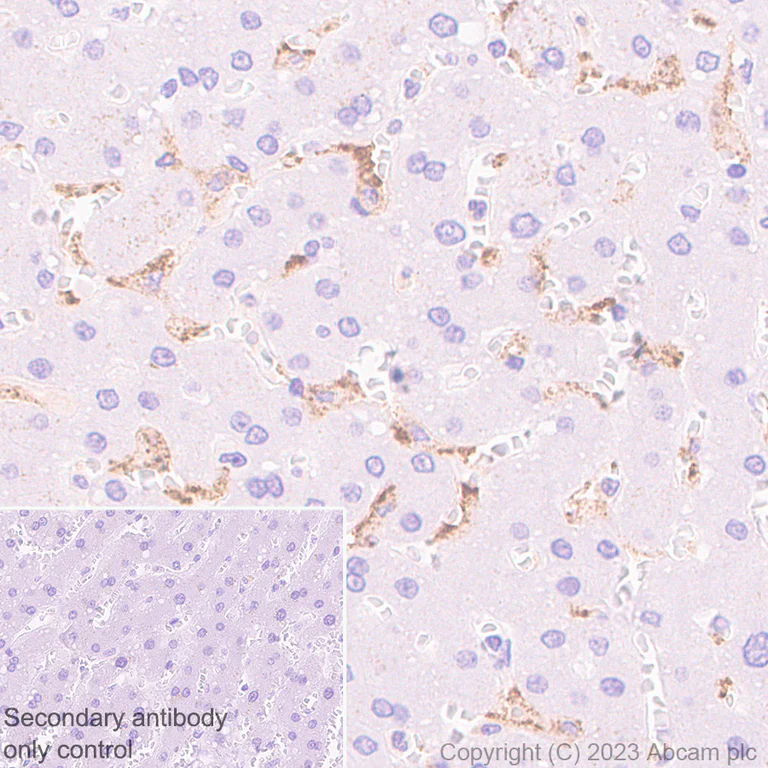Immunohistochemistry (Formalin/PFA-fixed paraffin-embedded sections) - Anti-MARCO antibody [EPR26935-11] - BSA and Azide free (AB314647)