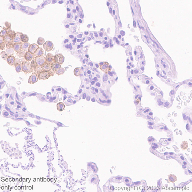 Immunohistochemistry (Formalin/PFA-fixed paraffin-embedded sections) - Anti-MARCO antibody [EPR26935-11] - BSA and Azide free (AB314647)